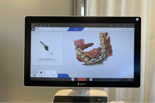 スキャナーでの口腔内画像