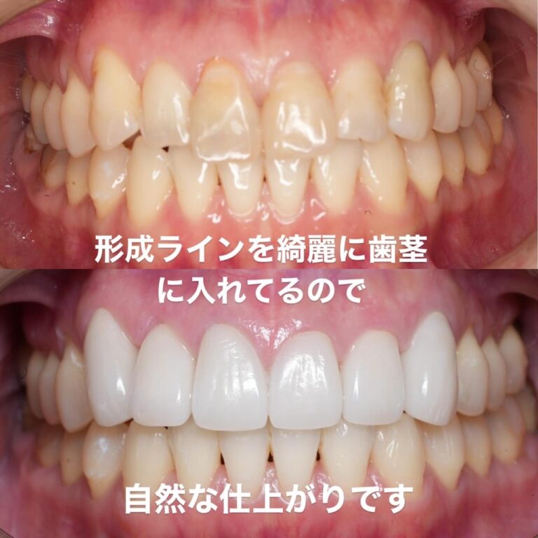 審美歯科